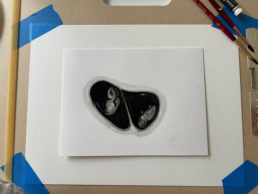 Custom Ultrasound Painting